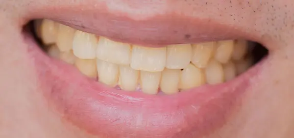Los 15 alimentos que más manchan los dientes y afectan tu sonrisa en 2026