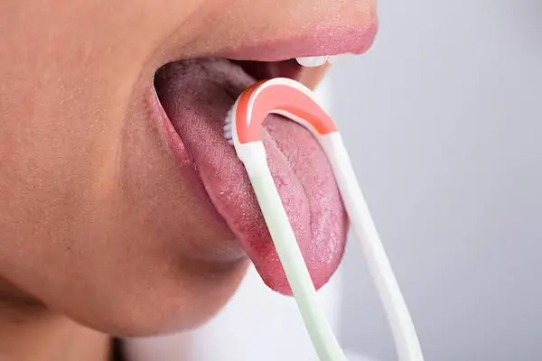 Cómo prevenir y tratar la lengua blanca