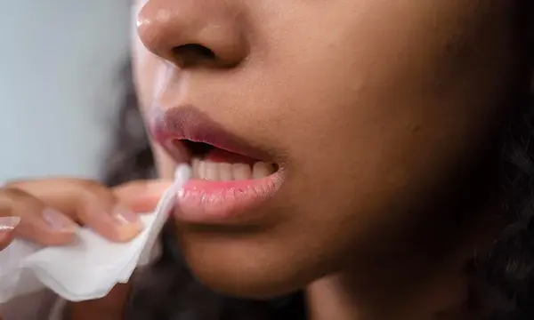 Cuáles son las principales causas de la sequedad bucal
