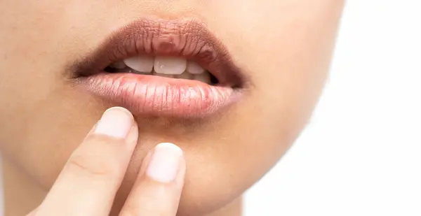 Qué significa tener la boca seca